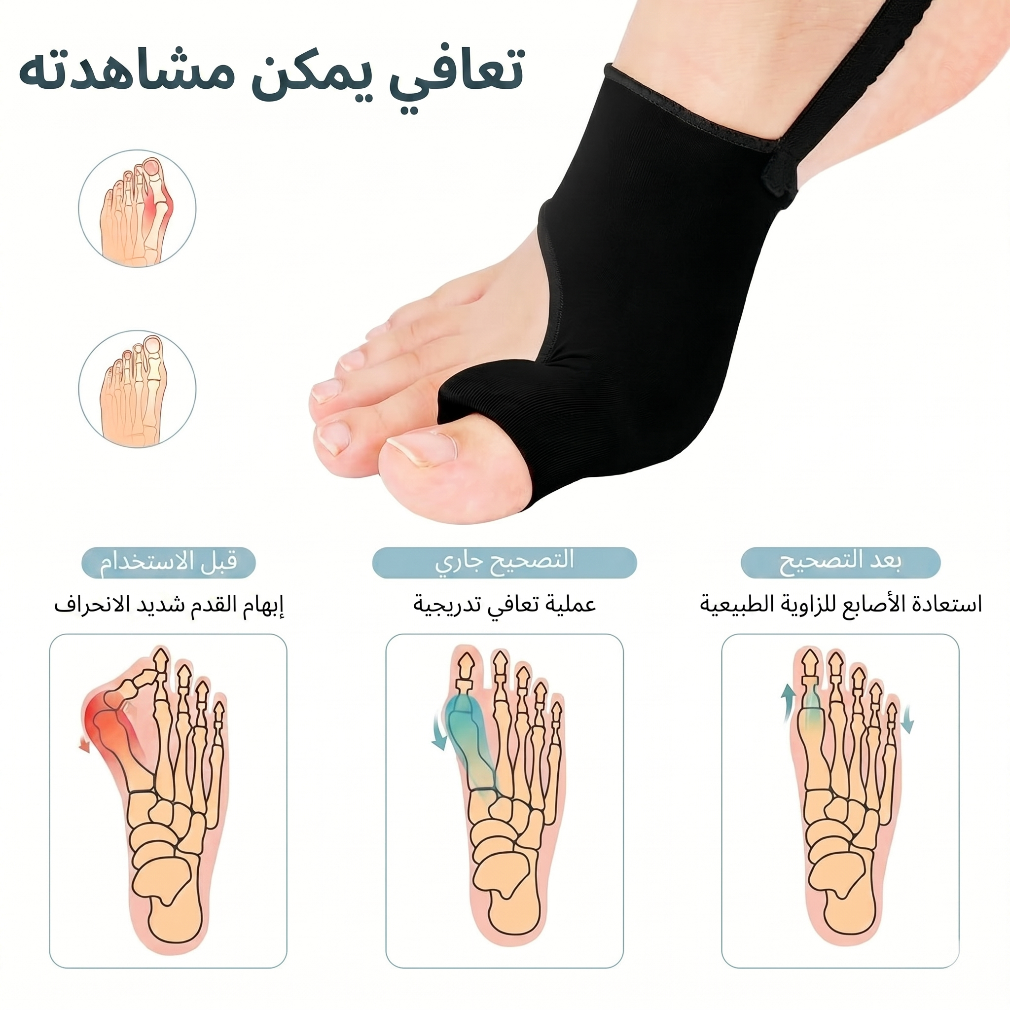 مصحح إبهام القدم من Vitella (متعدد الاستخدامات)